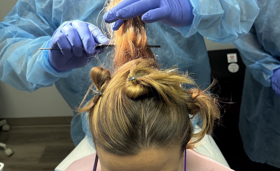 PRP Hair Restoration, prp for hair, PBC Hair Restoration, prp hair loss, PBC hair restoration treatment, platelet rich plasma for hair loss, prp hair loss treatment, Regenerative Hair Restoration, Regenerative Hair Growth, Regenerative Hair Regrowth