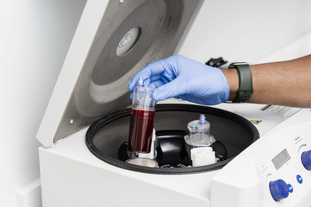 Women’s Hair Loss Clinic, Hair Loss Clinics Near Me, Hair Loss Clinic Naples, Hair Loss Clinic Fort Myers, , Hair Restoration Clinics in Naples, Hair Restoration Clinics in Fort Myers, Hair loss clinics near me, Women’s Hair Thinning Treatment, Doctors that treat thinning hair, Dermatologists that treat thinning hair, Hair Regrowth Clinics Near Me, Womens Hair growth Treatment, Doctors that restore hair growth, Hair Growth Clinics, women’s hair restoration, doctors that restore hair growth, doctors that specialize in hair restoration, non surgical hair restoration treatment, women’s hair restoration treatment, women’s hair restoration near me, Alopecia Dermatologist Near Me, Trichologist Near Me, Trichologist Naples Florida, Women’s Hair Restoration Clinics Near Me, Women’s Hair Restoration Near Me, Naples Hair Restoration, Fort Myers Hair Restoration, PRP Hair Restoration, prp for hair, PBC Hair Restoration, prp hair loss, PBC hair restoration treatment, platelet rich plasma for hair loss, prp hair loss treatment, Regenerative Hair Restoration, Regenerative Hair Growth, Regenerative Hair Regrowth, Naples Hair Loss Treatment, Fort Myers Hair Loss Treatment, Non-surgical hair loss treatment, Non-surgical hair growth treatment, Women’s hair growth treatment, Non-surgical hair regrowth treatment, Women’s hair regrowth treatment, Female hair growth treatment, Best hair growth treatment for women, hair thinning treatment for female, best treatment for hair growth, best non surgical hair loss treatment, Treating androgenic alopecia