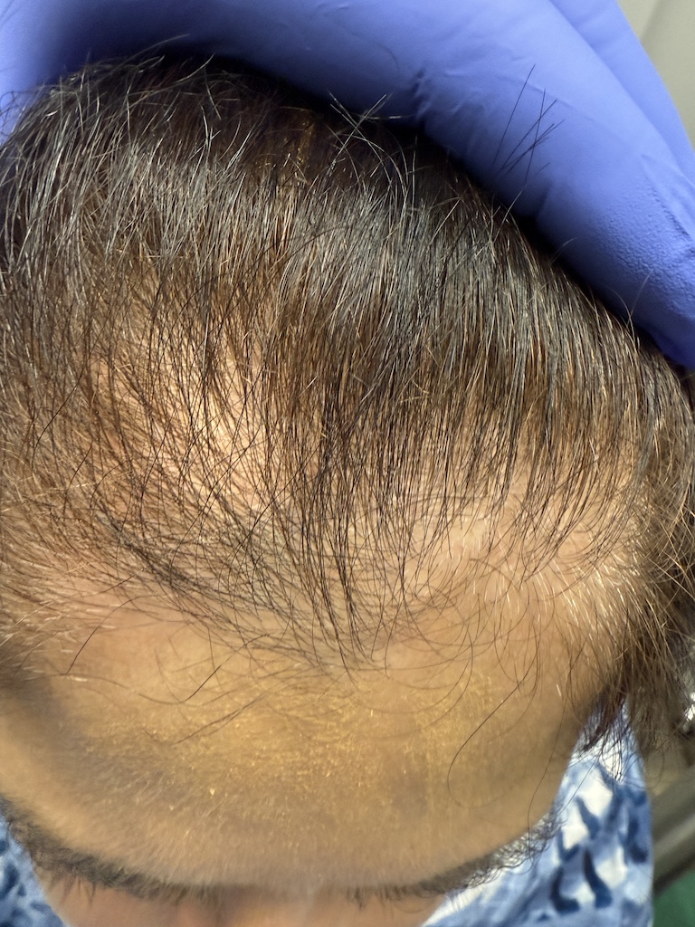 women’s hair thinning treatment, treating women’s thinning hair, doctors that treat thinning hair, women’s hair loss clinics, restoring hair growth, Restoring hair loss in women, restoring women’s hair loss