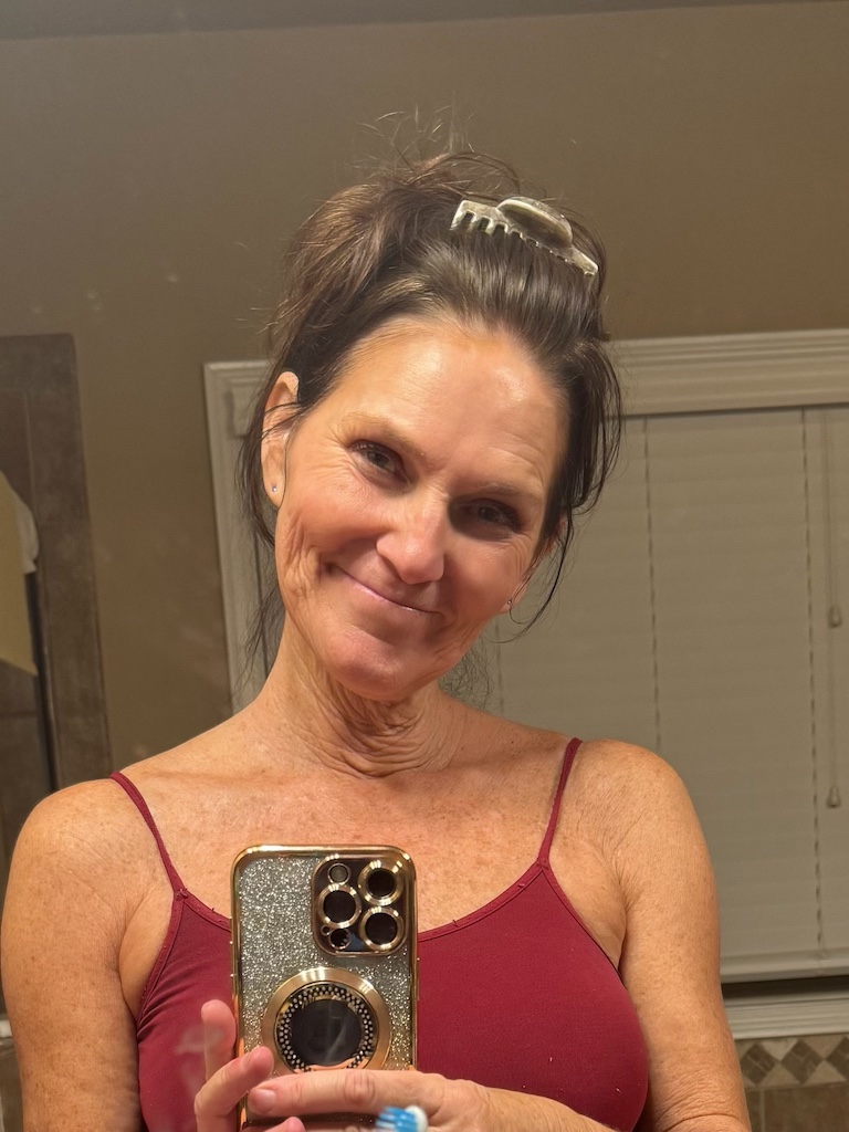 women’s hair restoration, doctors that restore hair growth, doctors that specialize in hair restoration, non surgical hair restoration treatment, women’s hair restoration treatment, women’s hair restoration near me, Alopecia Dermatologist Near Me, Trichologist Near Me, Trichologist Naples Florida, Women’s Hair Restoration Clinics Near Me, Women’s Hair Restoration Near Me, Naples Hair Restoration, Fort Myers Hair Restoration