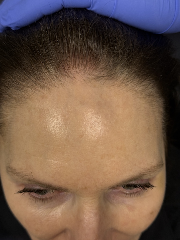 women’s hair thinning treatment, treating women’s thinning hair, doctors that treat thinning hair, women’s hair loss clinics, restoring hair growth, Restoring hair loss in women, restoring women’s hair loss