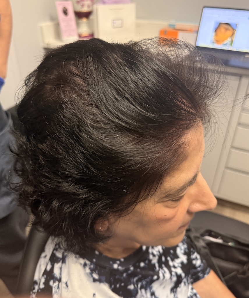 women’s hair thinning treatment, treating women’s thinning hair, doctors that treat thinning hair, women’s hair loss clinics, restoring hair growth, Restoring hair loss in women, restoring women’s hair loss